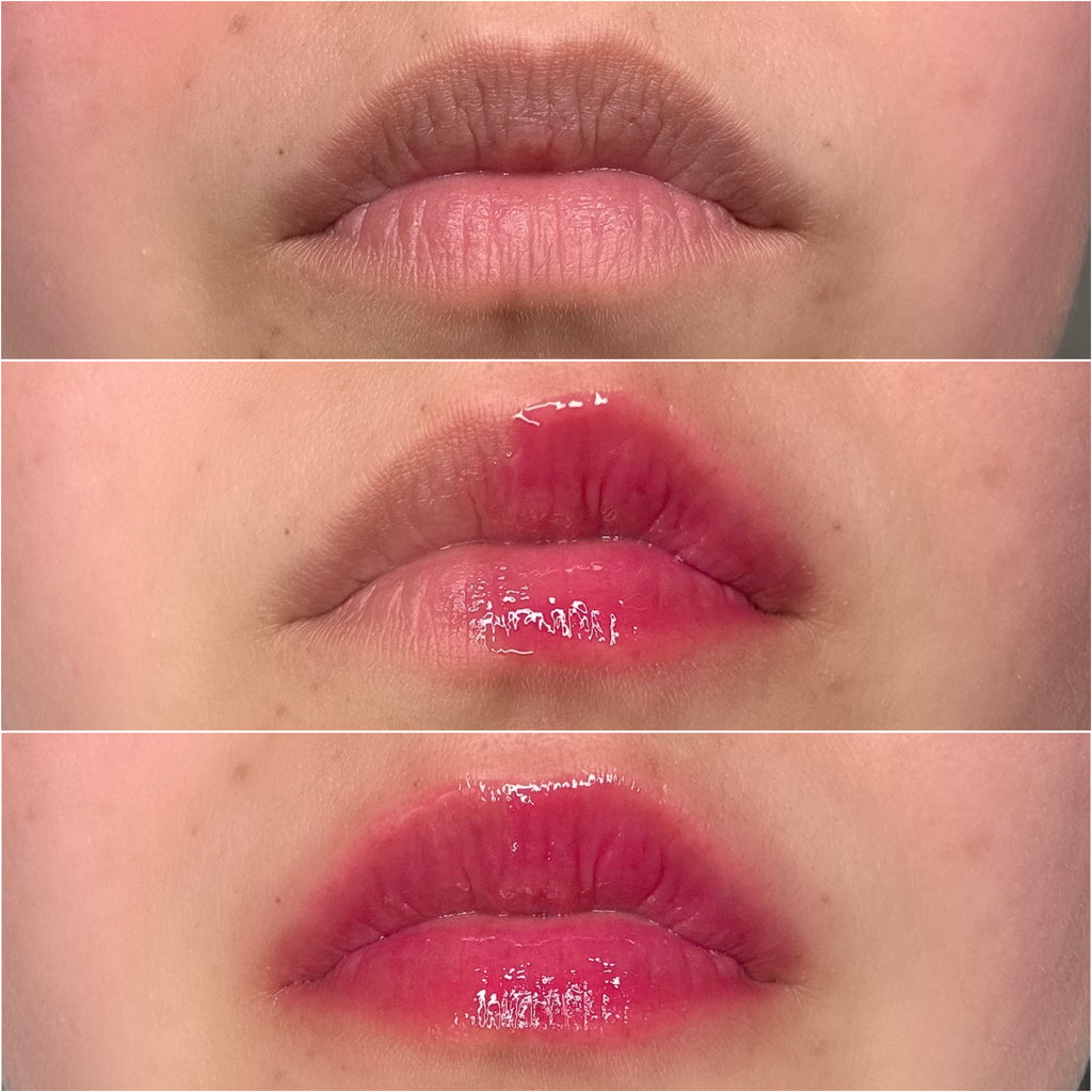 Lip Plumper